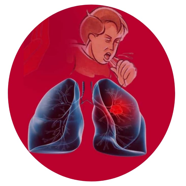 क्षयरोग निर्मूलन दिवस